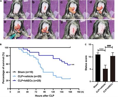 Human Amnion Epithelial Cells and Their Derived Exosomes Alleviate Sepsis-Associated Acute Kidney Injury via Mitigating Endothelial Dysfunction